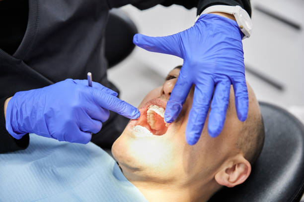 Best Emergency Wisdom Teeth Removal in Tuckerton, NJ